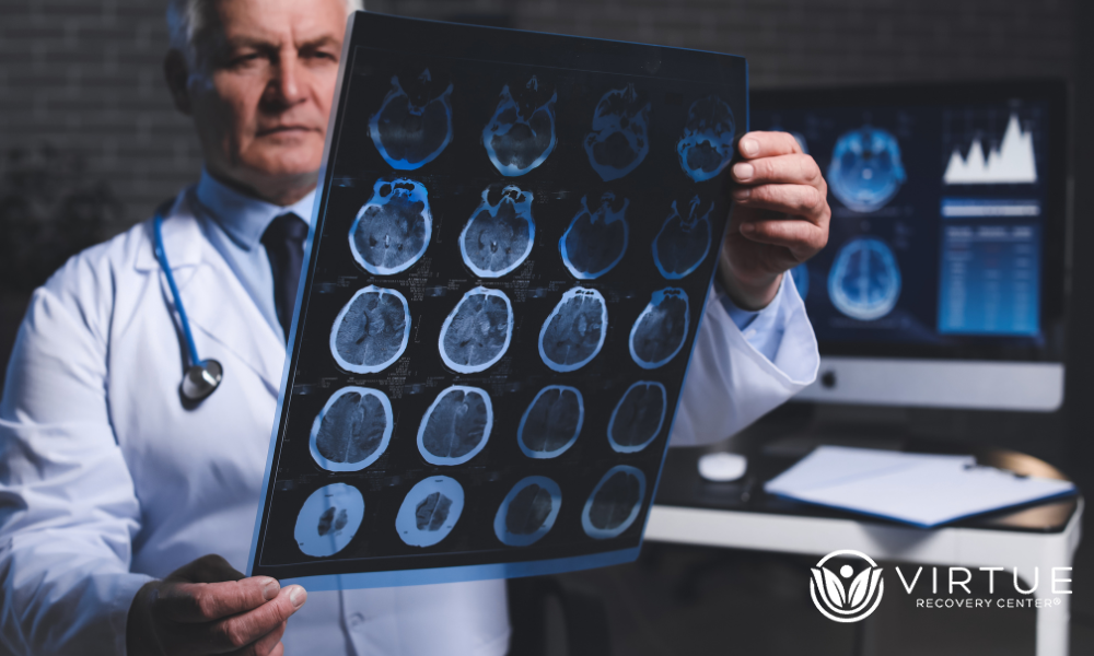 Brain imaging studies | Virtue Recovery Killeen Brain imaging studies